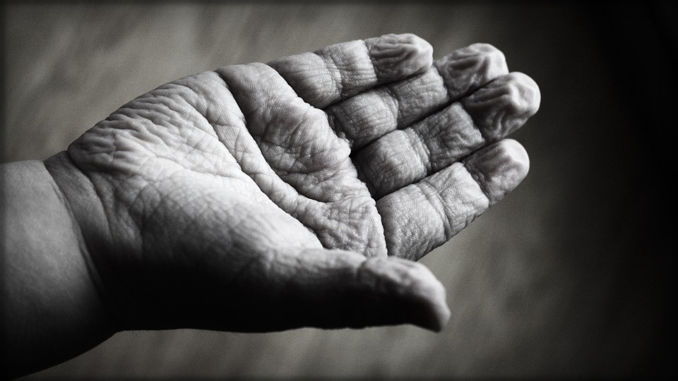 Treating Swollen Fingers